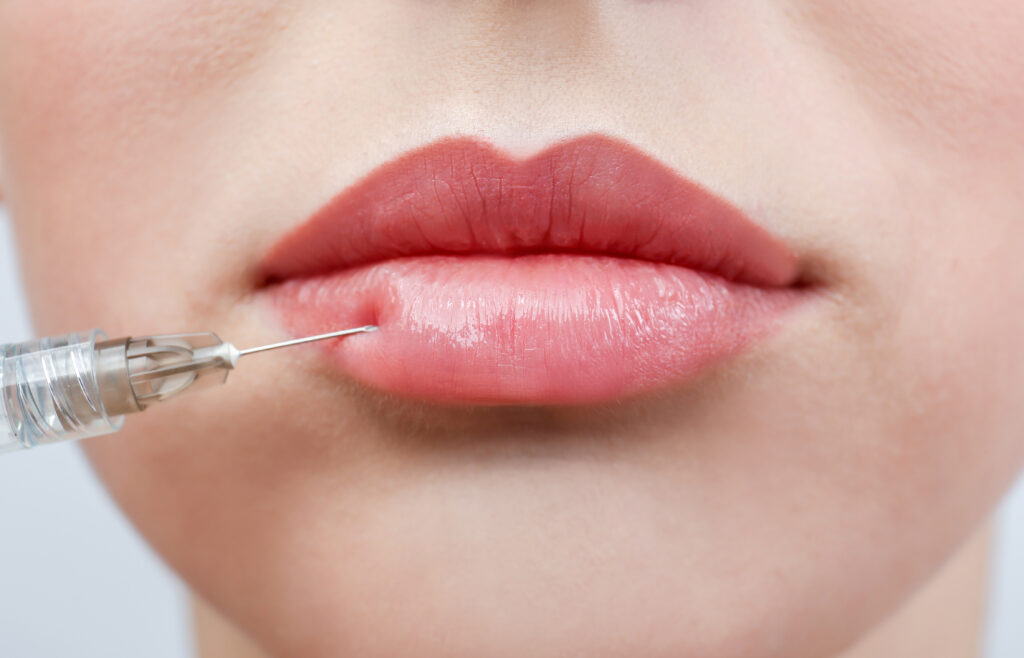 Woman Receiving Filler Injections in her Lips
